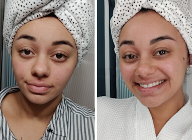 Alexis V. before and after