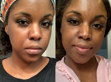 Jen J. before and after