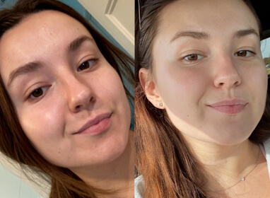 Polina C. before and after
