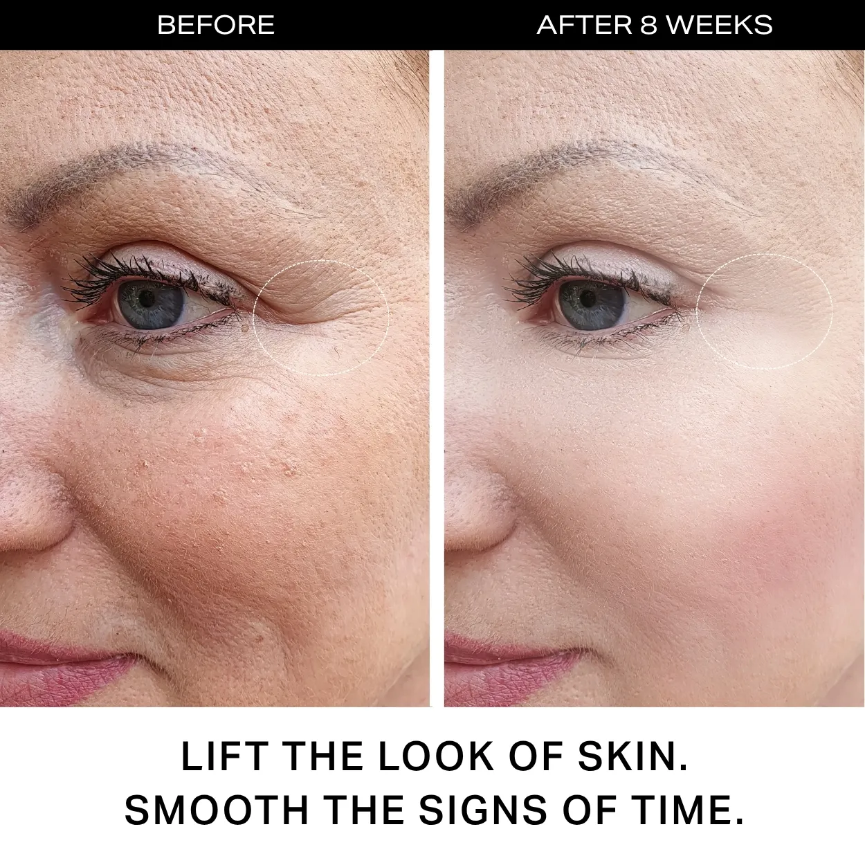 Y'OUR 4-step personalized skincare curated to your unique skin's needs