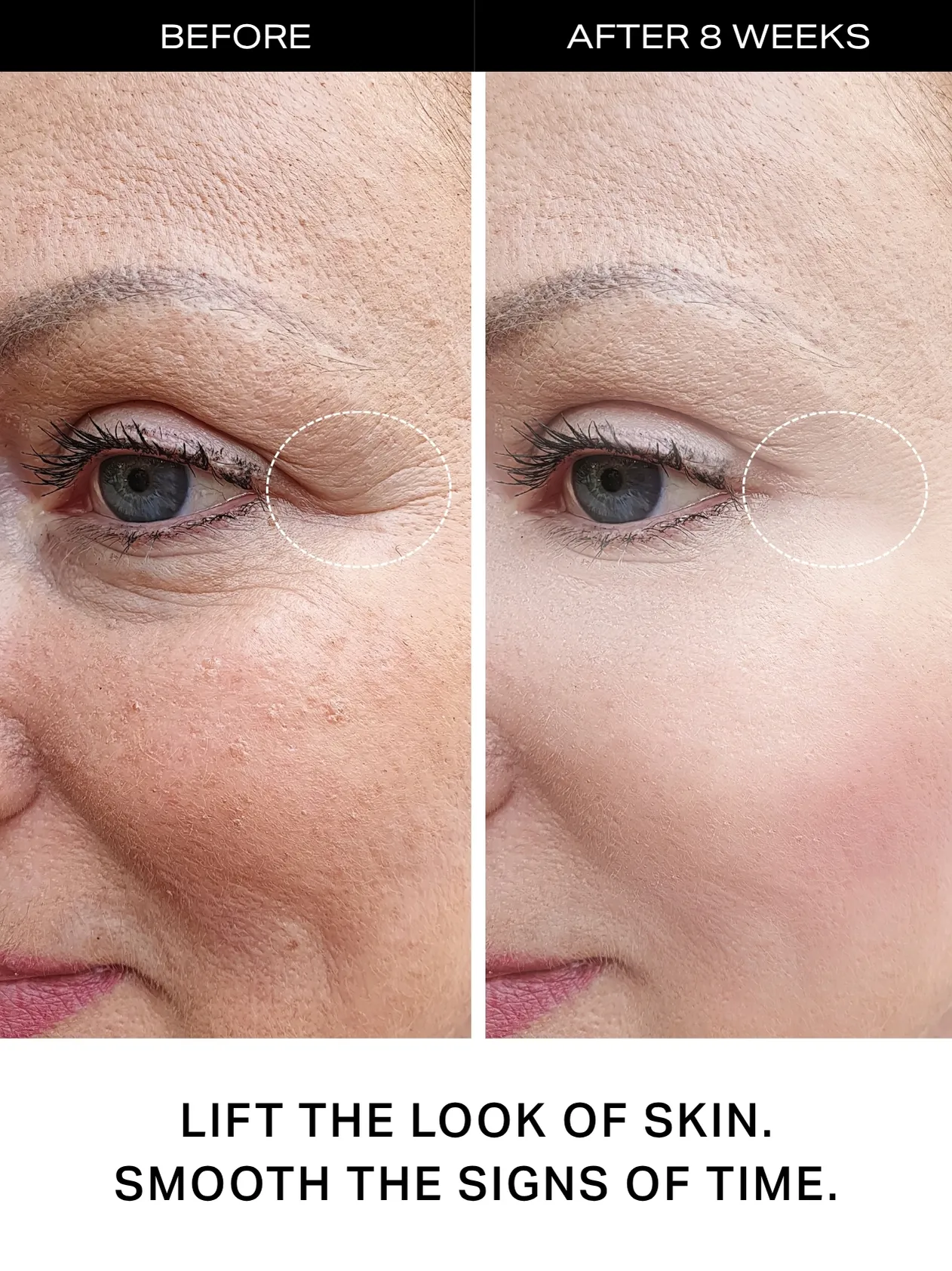 Y'OUR 4-step personalized skincare curated to your unique skin's needs