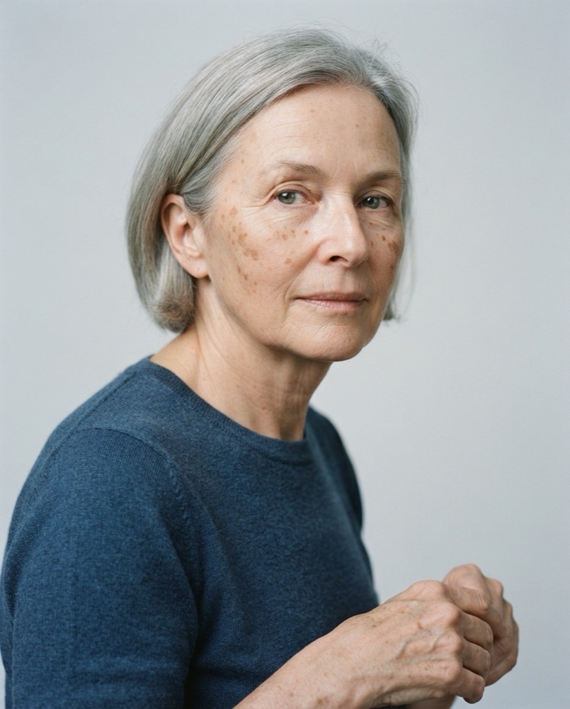 age spots
