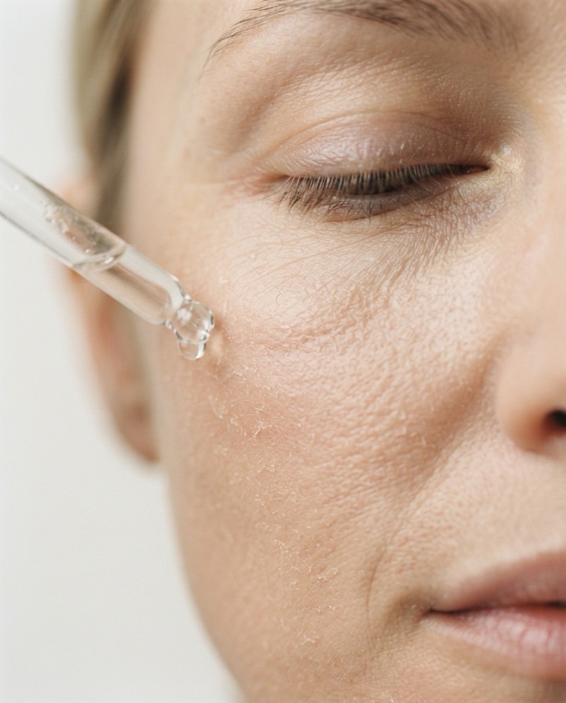 dry skin