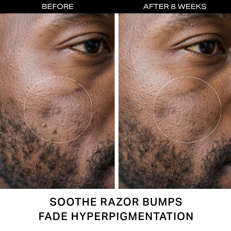Black Men Skin