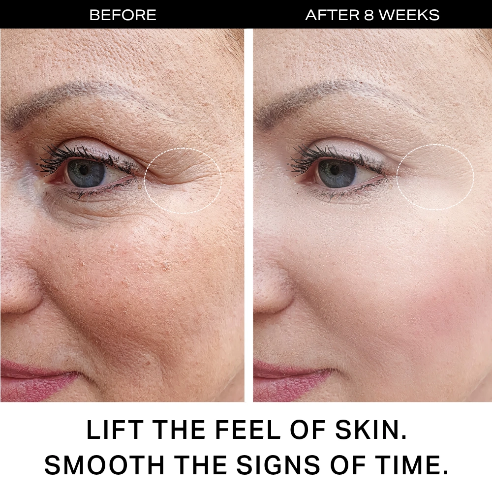Menopausal Skin