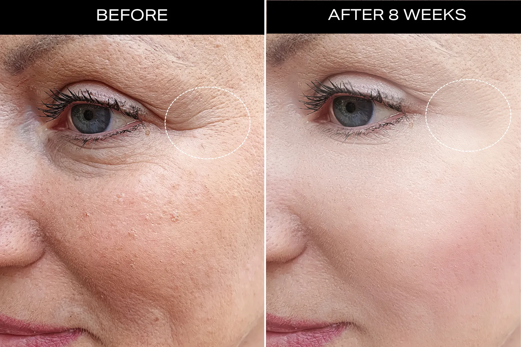 Visible Healthier Skin