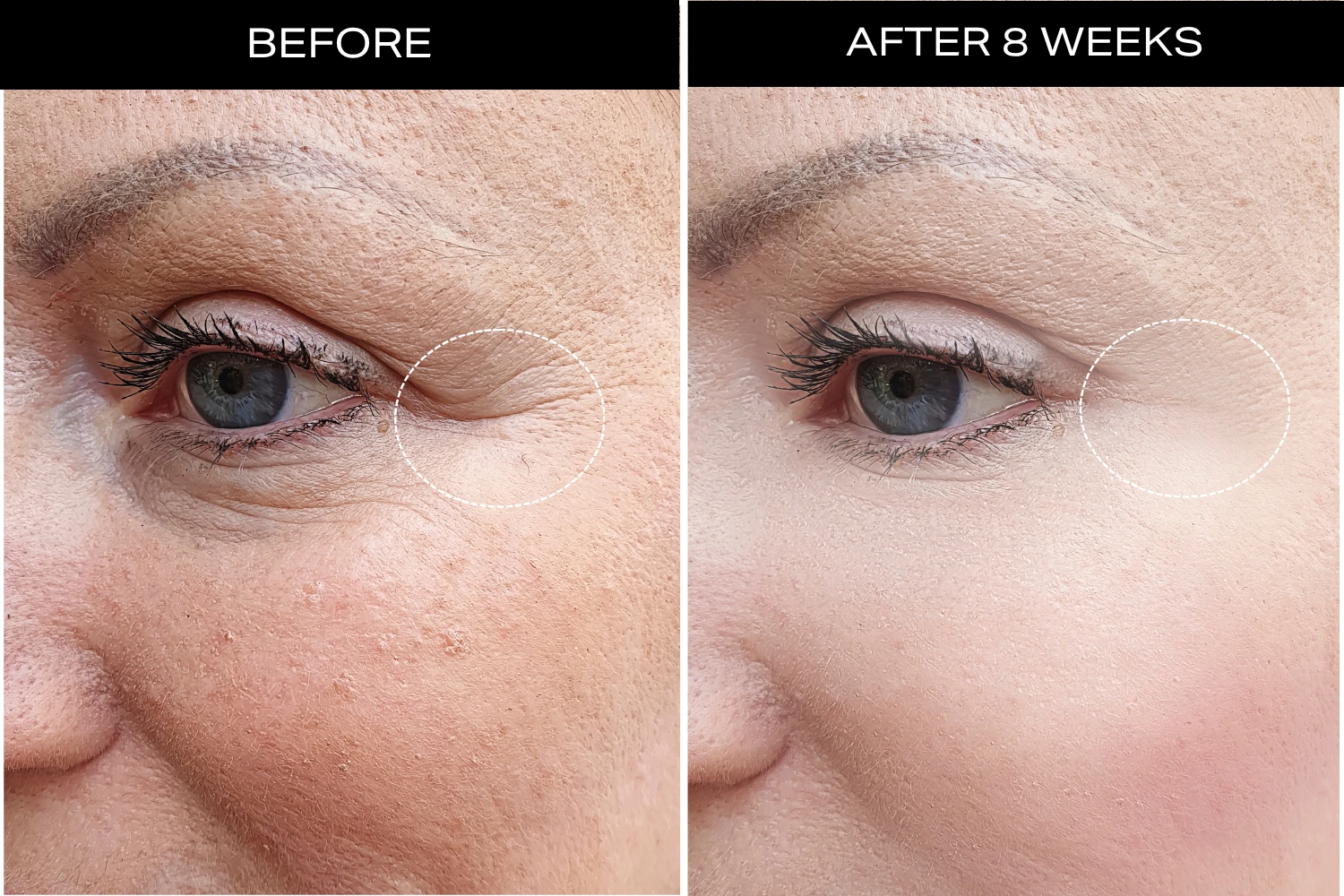 Visibly Plumper Skin