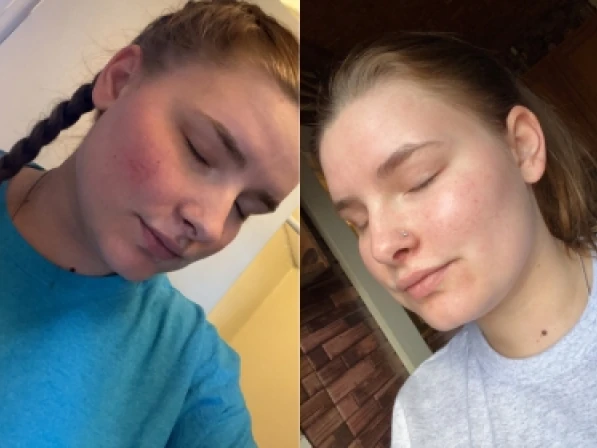 Courtney B. before and after