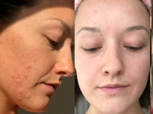 Sydney before and after